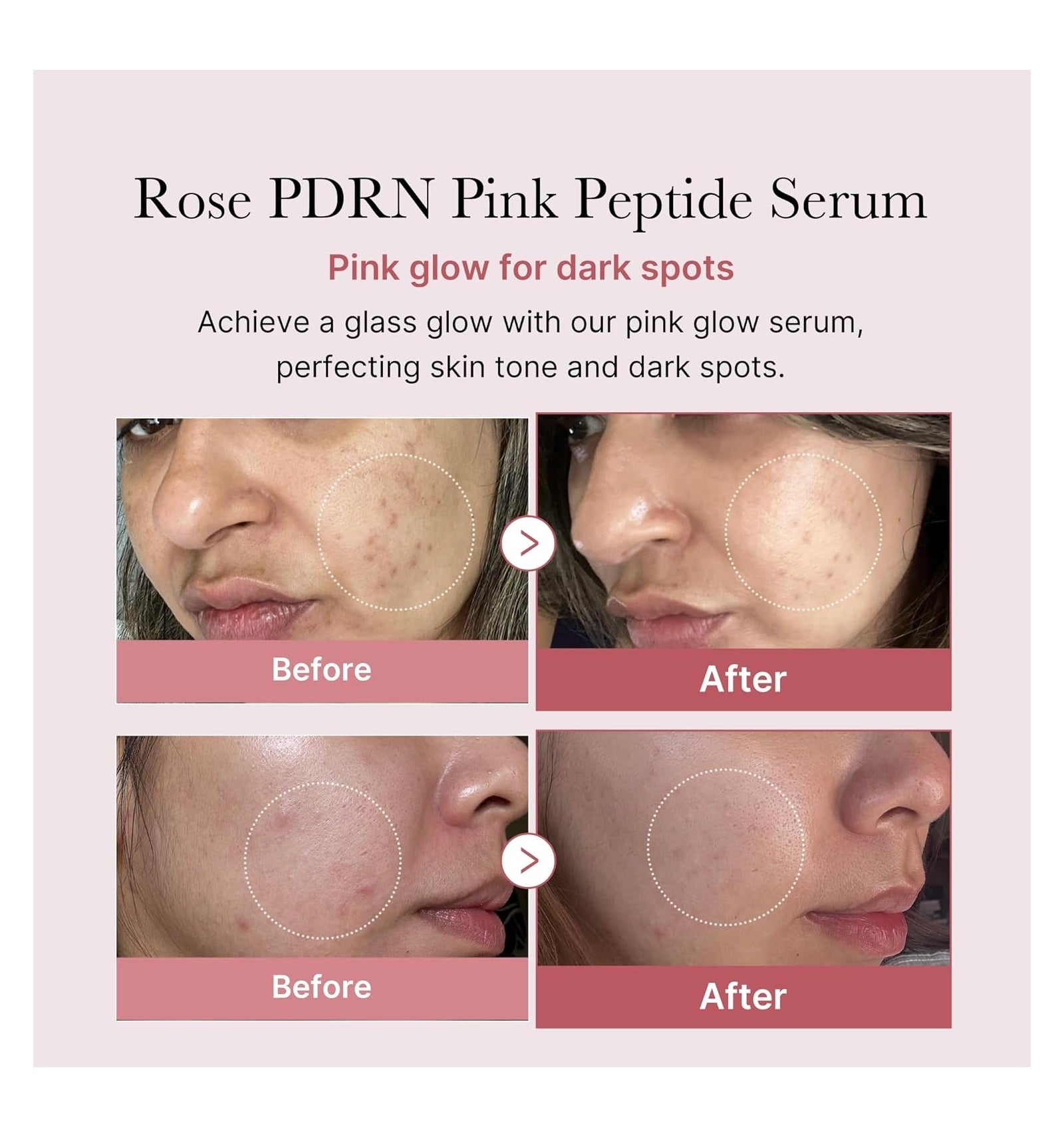 PDRN Pink Peptide Serum