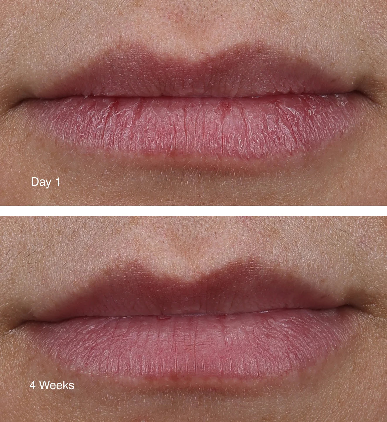 Peptide Lip Treatment