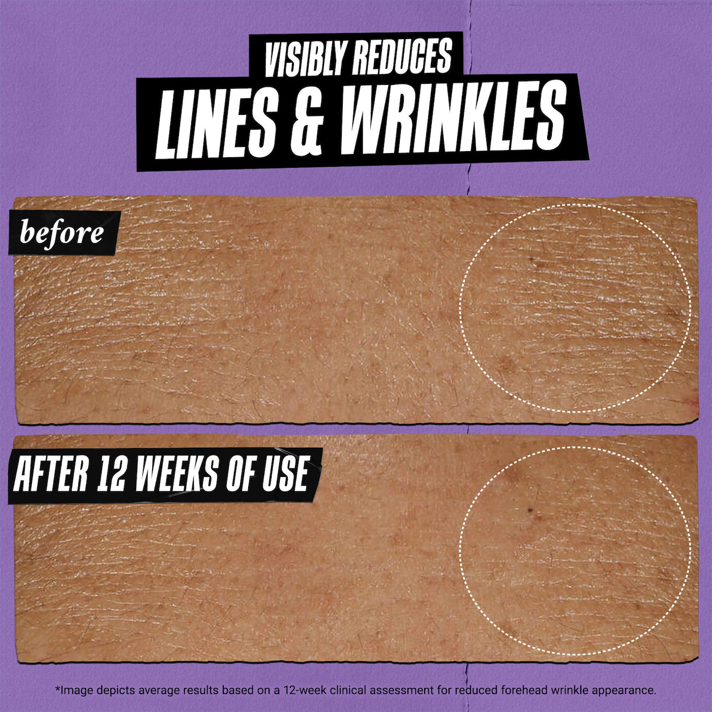 Retinol Skin-Renewing Daily Micro-Dose Serum