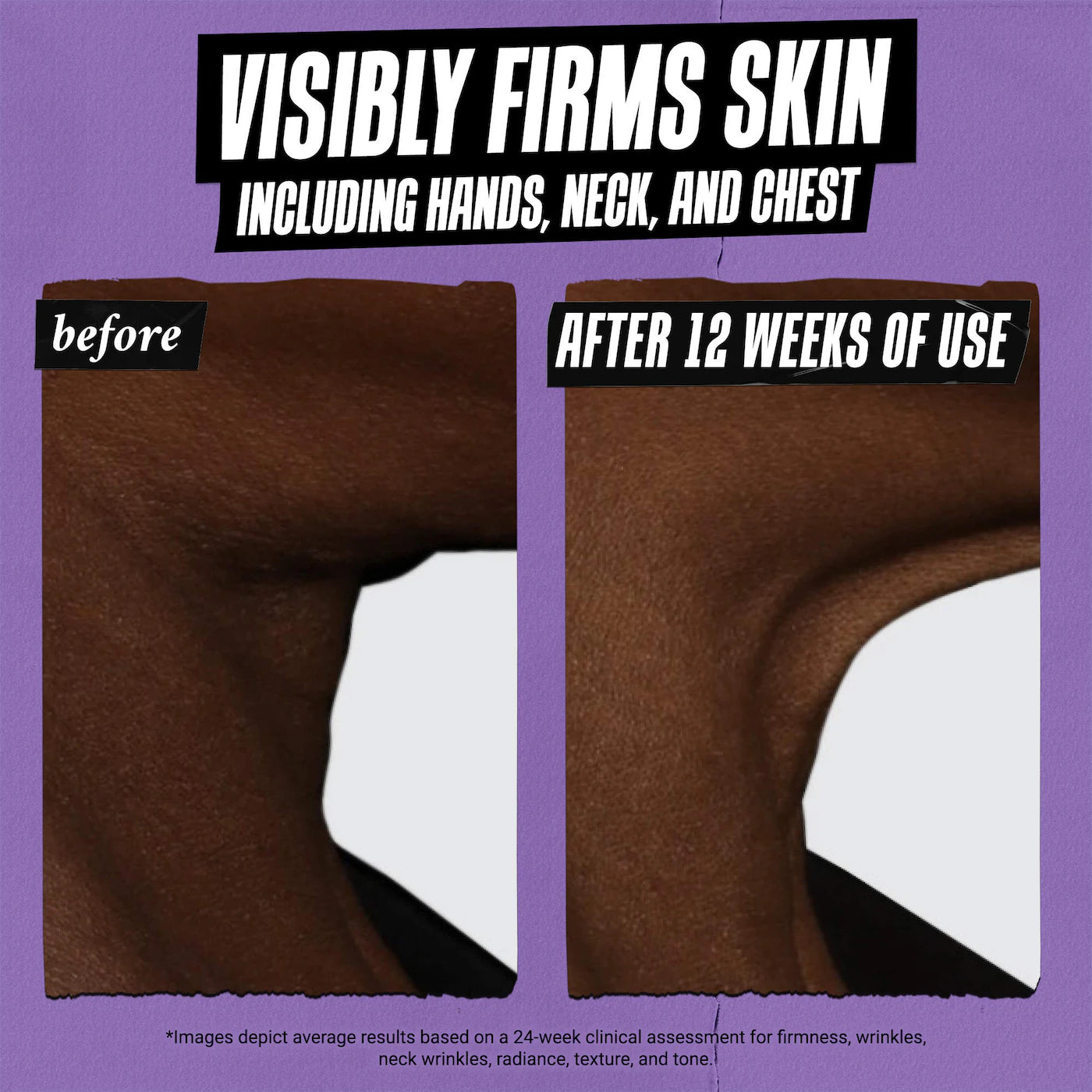 Retinol Skin-Renewing Daily Micro-Dose Serum