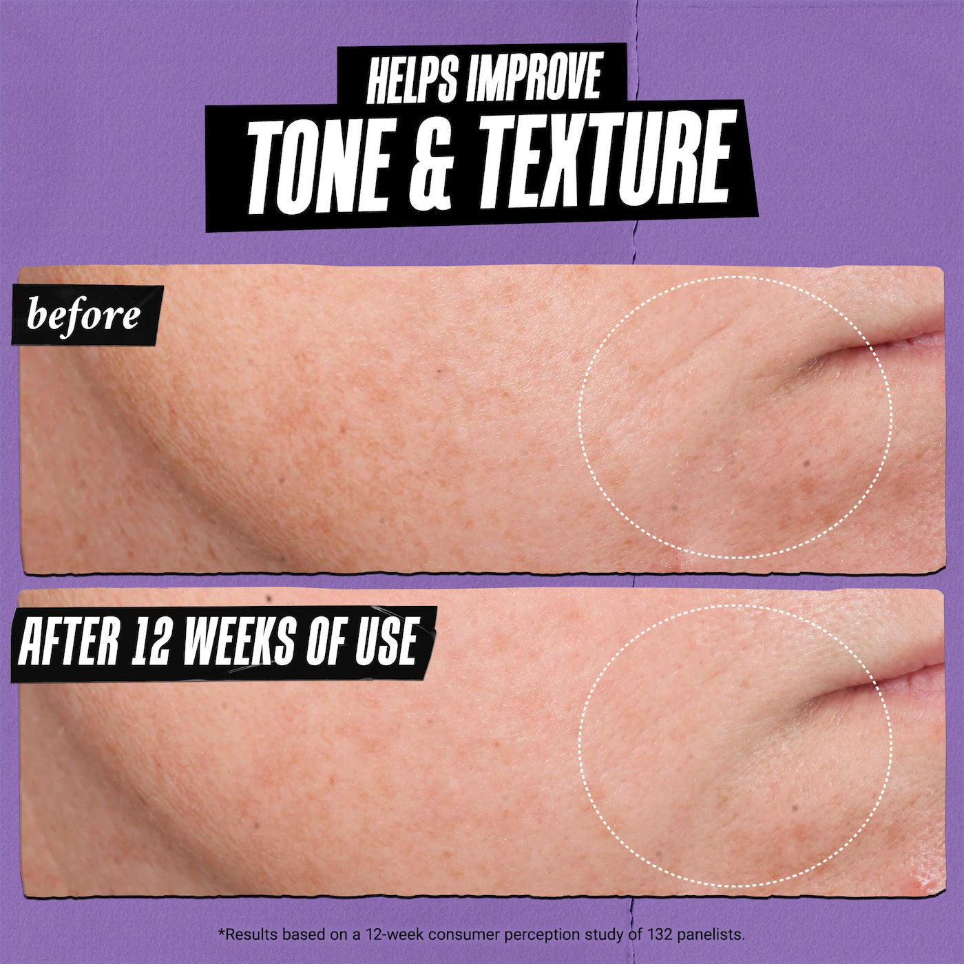 Retinol Skin-Renewing Daily Micro-Dose Serum
