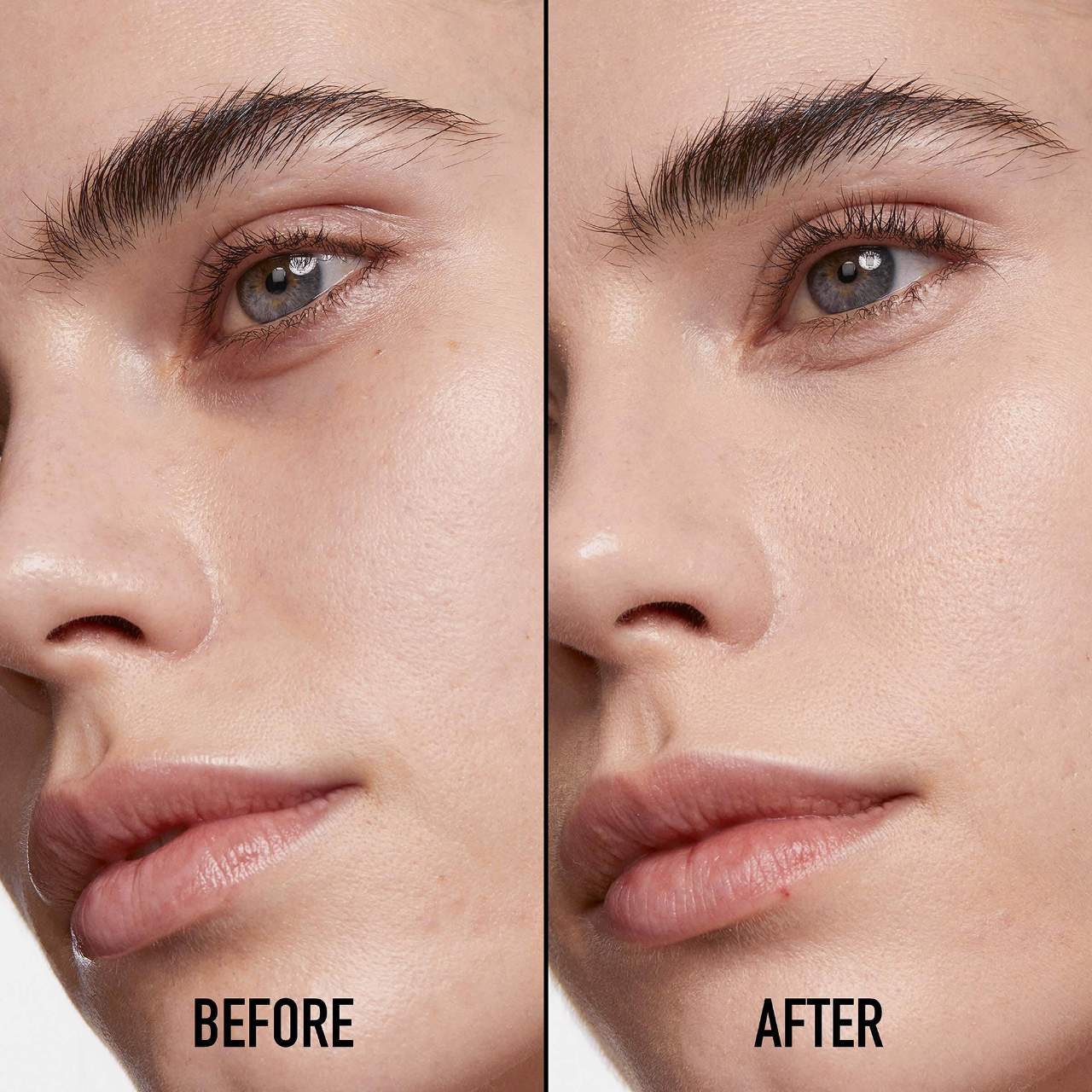 Forever Skin Correct