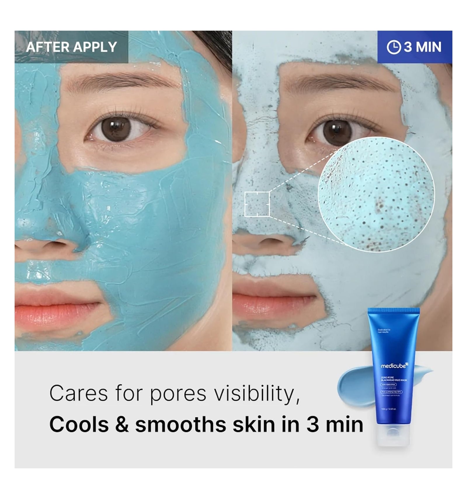 Zero Pore Blackhead Mud Mask